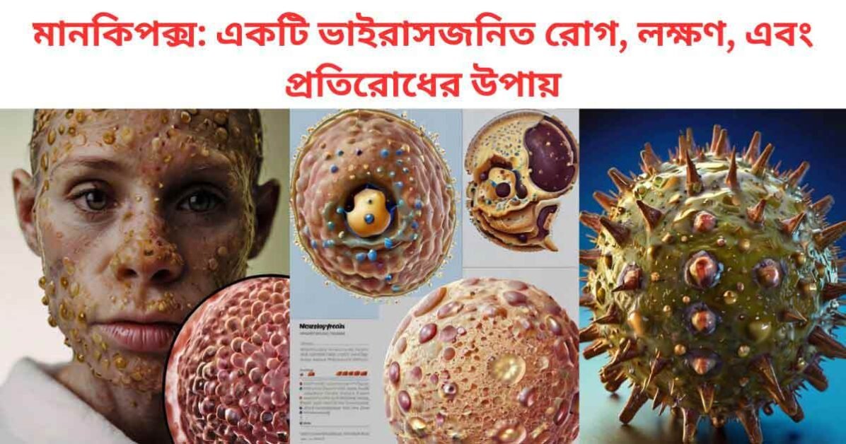 Danger মানকিপক্স: রোগ, লক্ষণ, এবং প্রতিরোধের উপায় 2024 1 মানকিপক্স