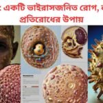 ওয়েবসাইটের গতি বাড়ানোর উপায় : ১২টি কার্যকরী ধাপ 2025 মানকিপক্স